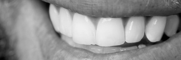 Conseils et précautions - Dentiste Osny
